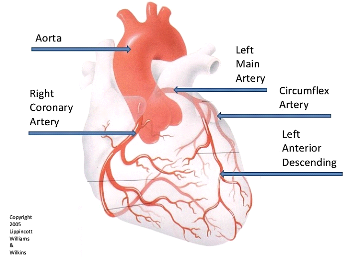 Coronary Angiography – Heartwest